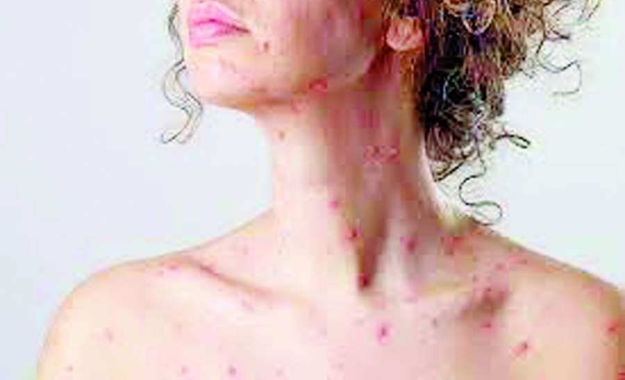 ဆောင်းပါး