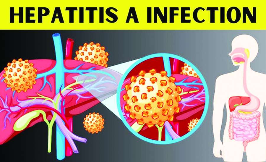 ဆောင်းပါး