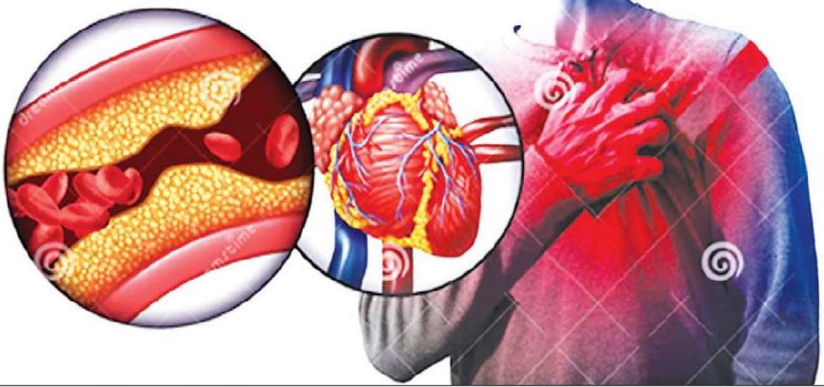 ျ်မါမ်ါ