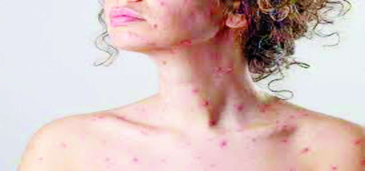 ဆောင်းပါး