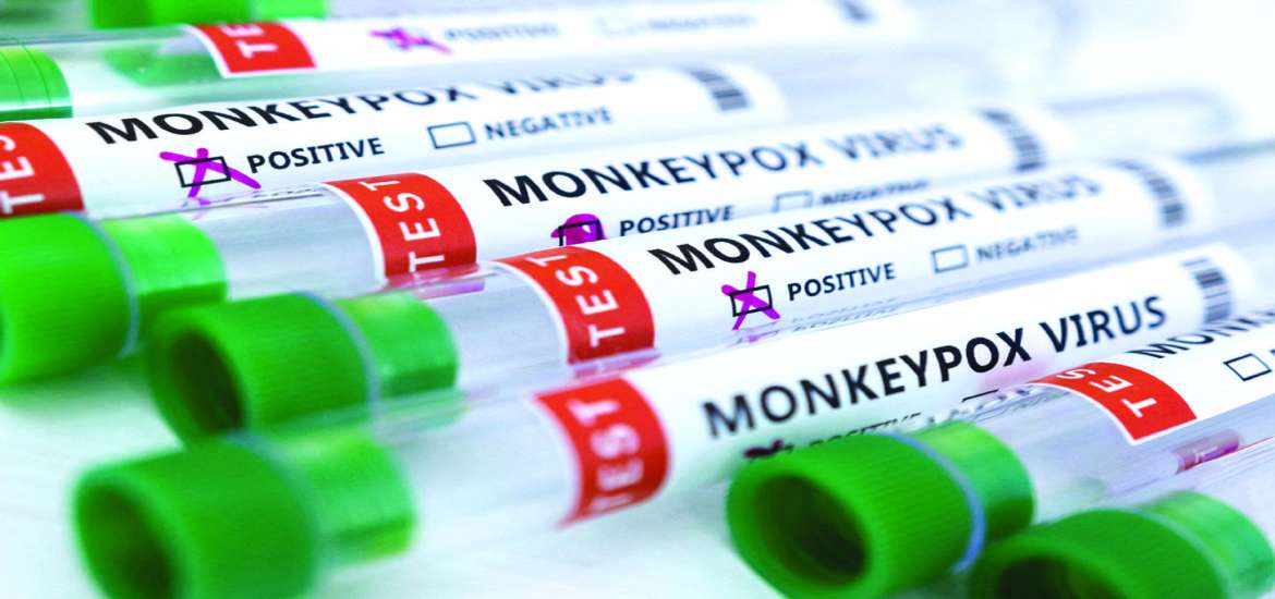 ဆောင်းပါး